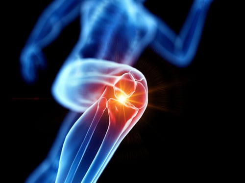 Bad Knees? How To Exercise with Unbearable Knee Pain